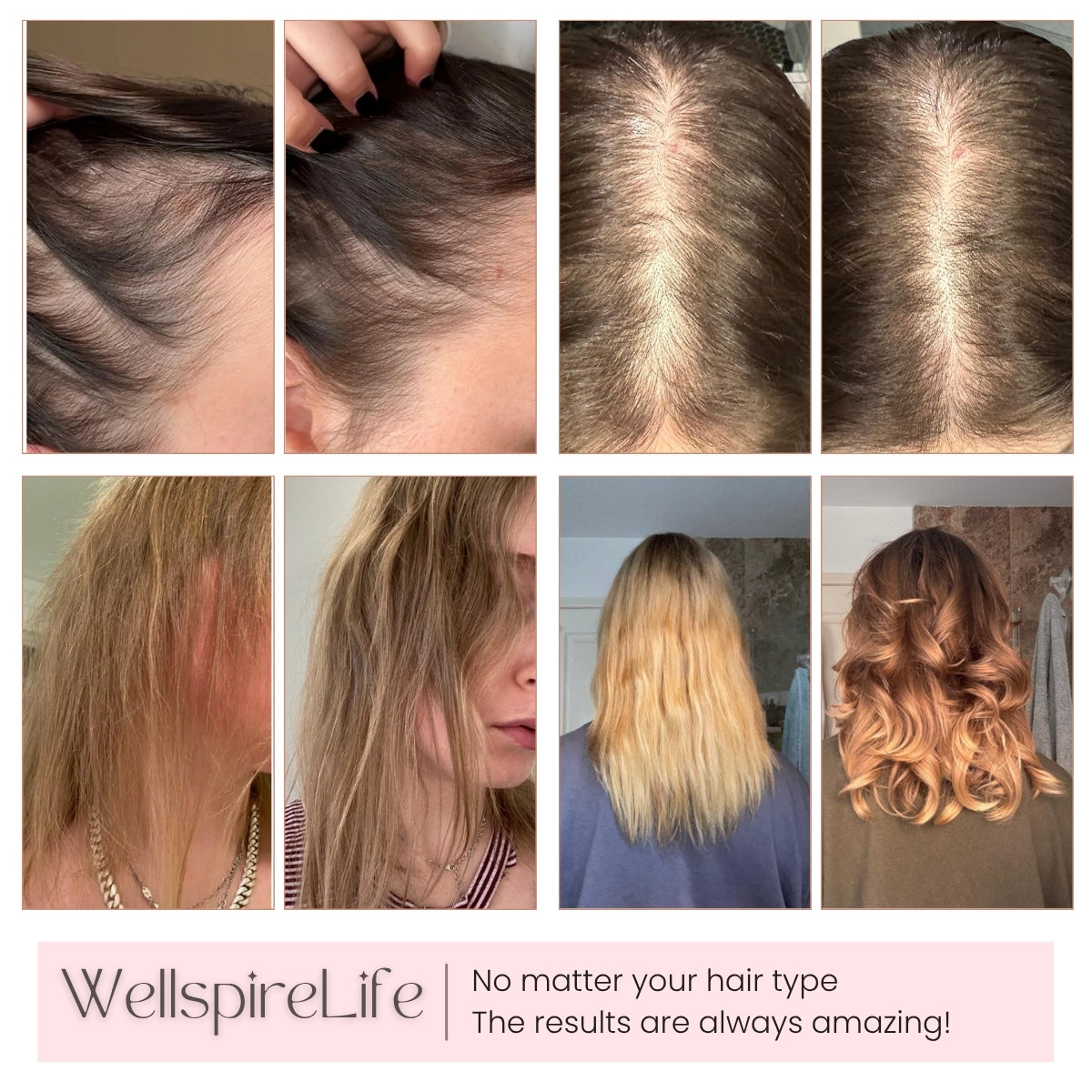 Wellspire Life Scalp Massager Comb