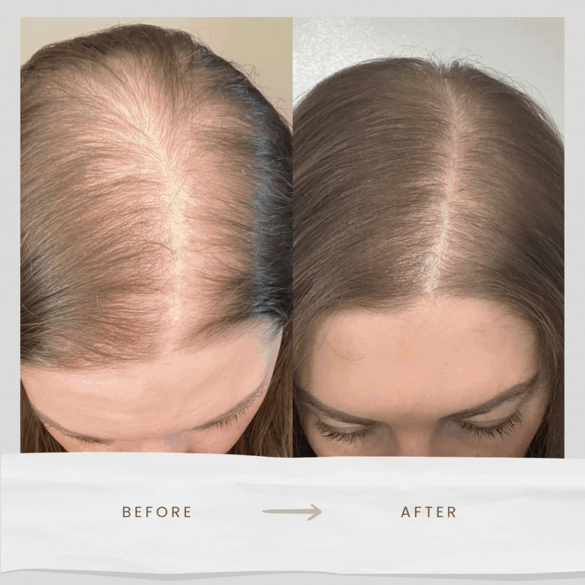 Wellspire Life Scalp Massager Comb